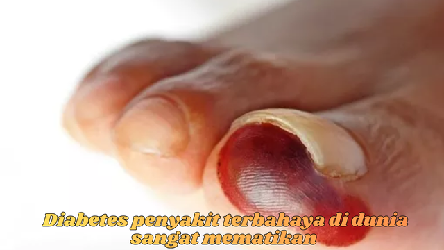 penyakit diabetes