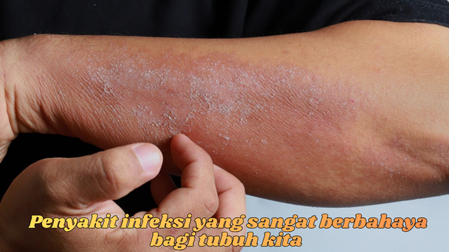 penyakit tubuh